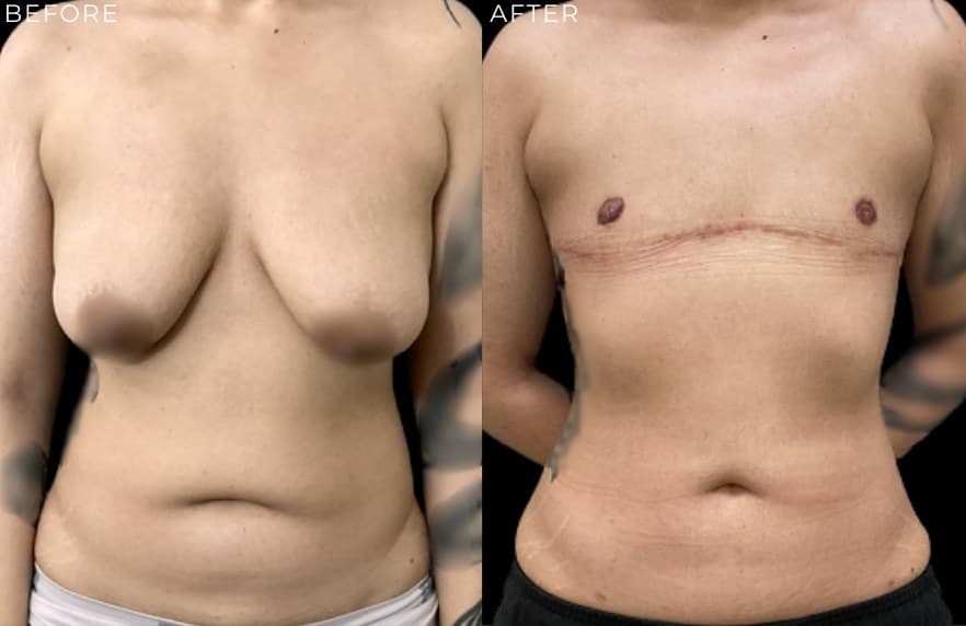 Omakase Body Restoration at The Self Institute