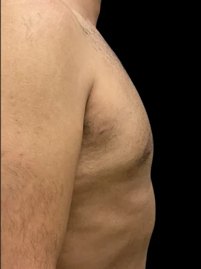 Patient 3 after