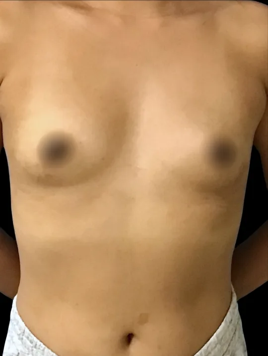 Patient 1 before
