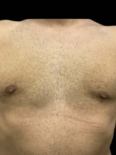 Patient 2 after